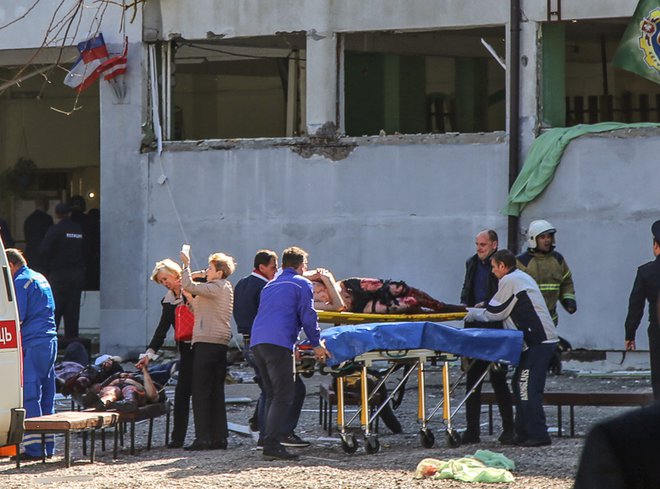 Številnim so morali amputirati okončine. FOTO: Afp