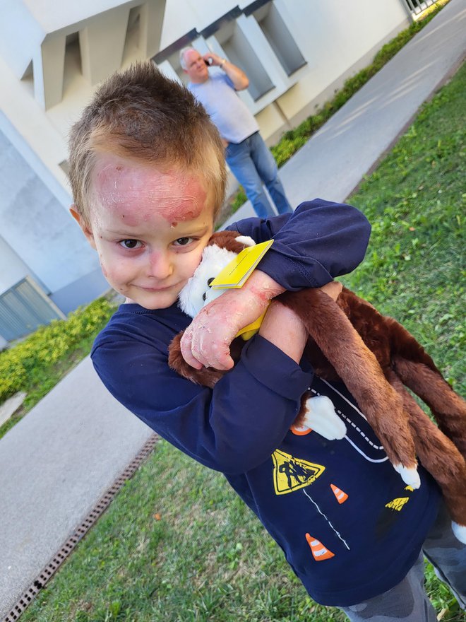 Miloš trpi za neozdravljivim metuljevim sindromom. FOTO: Osebni arhiv
