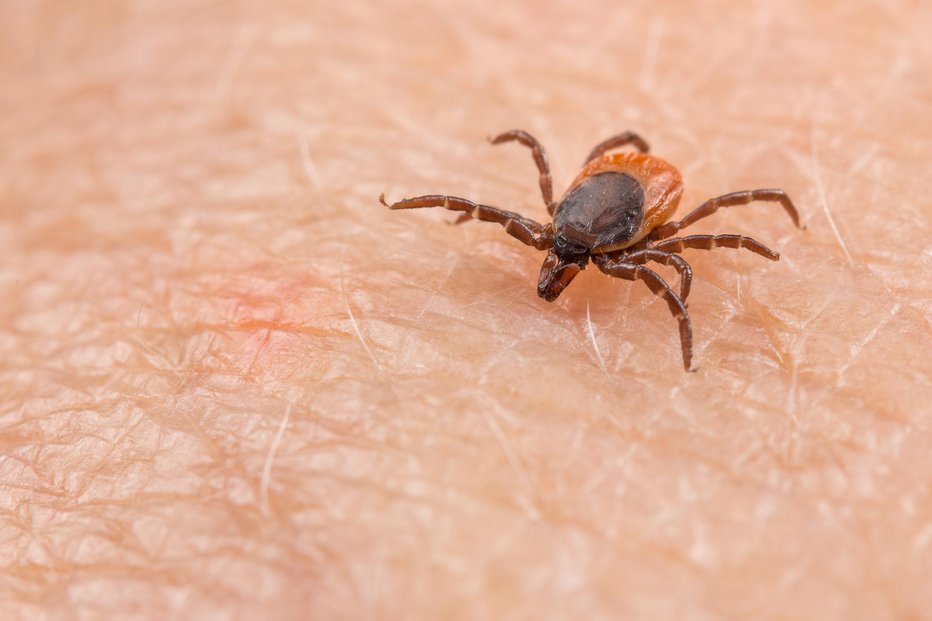 Fotografija: Po vsakem obisku narave temeljito pregledamo kožo celega telesa. FOTO: Getty Images/iStockphoto