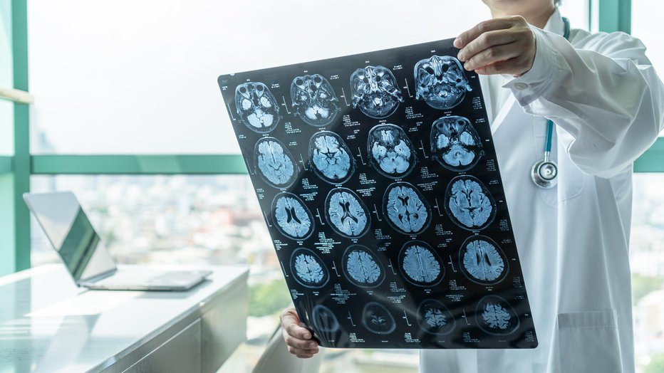 Fotografija: Zaradi hude Alzheimerjeve bolezni lahko pride do nezmožnosti prepoznavanja bližnjih družinskih članov in prijateljev. FOTO: Chinnapong Getty Images/istockphoto