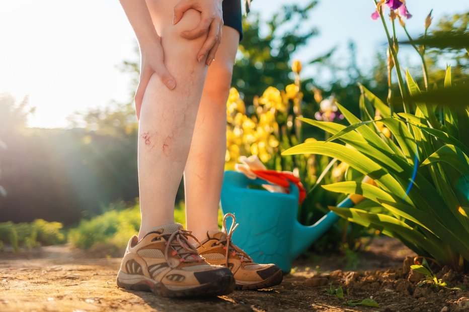 Fotografija: Polurni sprehod vsak dan bo razbremenil vene. FOTO: Shutterstock