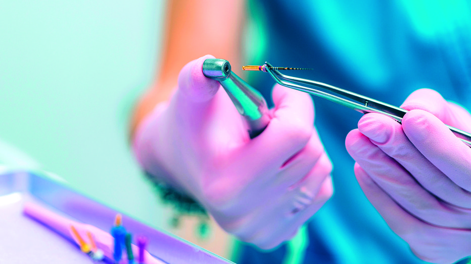 Fotografija: Sodobna specialistična endodontija je v zadnjih 20 letih postala najbolj tehnološko podprta veja zobozdravstva. FOTO: Shutterstock