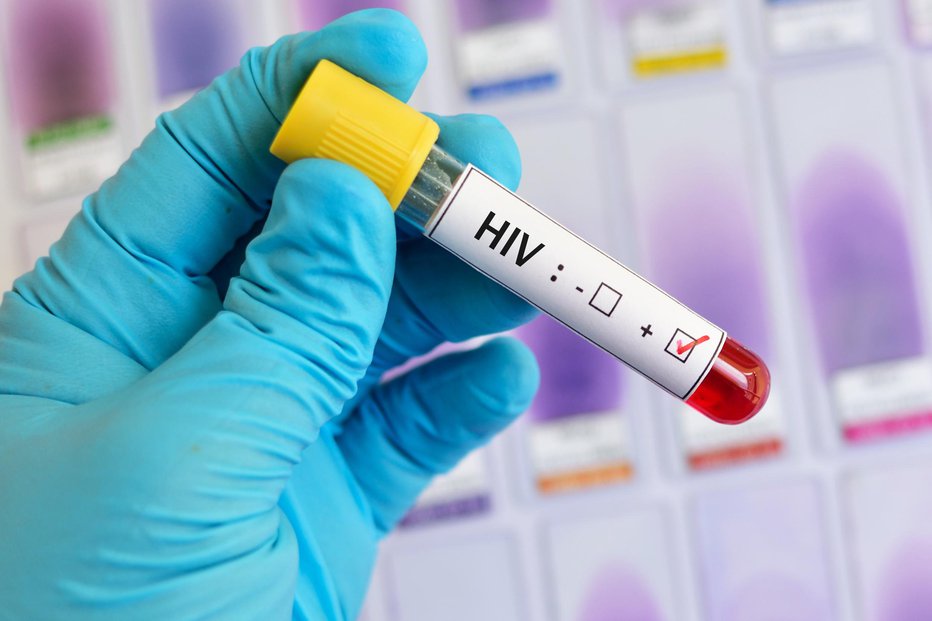 Fotografija: Lani je po svetu živelo okoli 40 milijonov okuženih z virusom HIV. FOTO: Jarun011/getty images