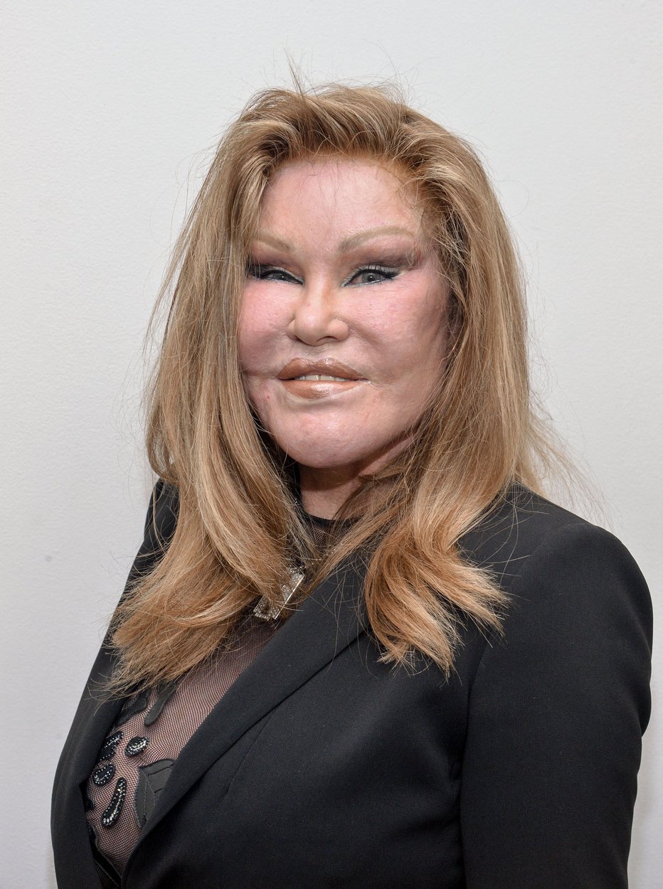 Fotografija: Jocelyn Wildenstein (na fotografiji iz leta 2015) je umrla v starosti 79 let. Foto: Grant Lamos/AFP